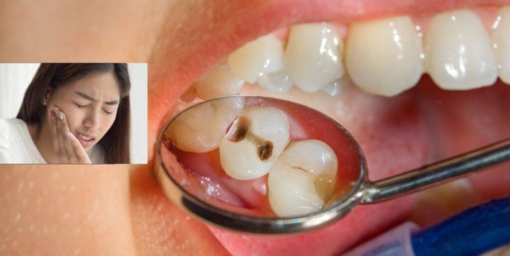 Harga cabut gigi klinik swasta 2021